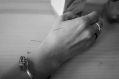 Ulyas hand on a table with two acupuncture needles sticking out of it